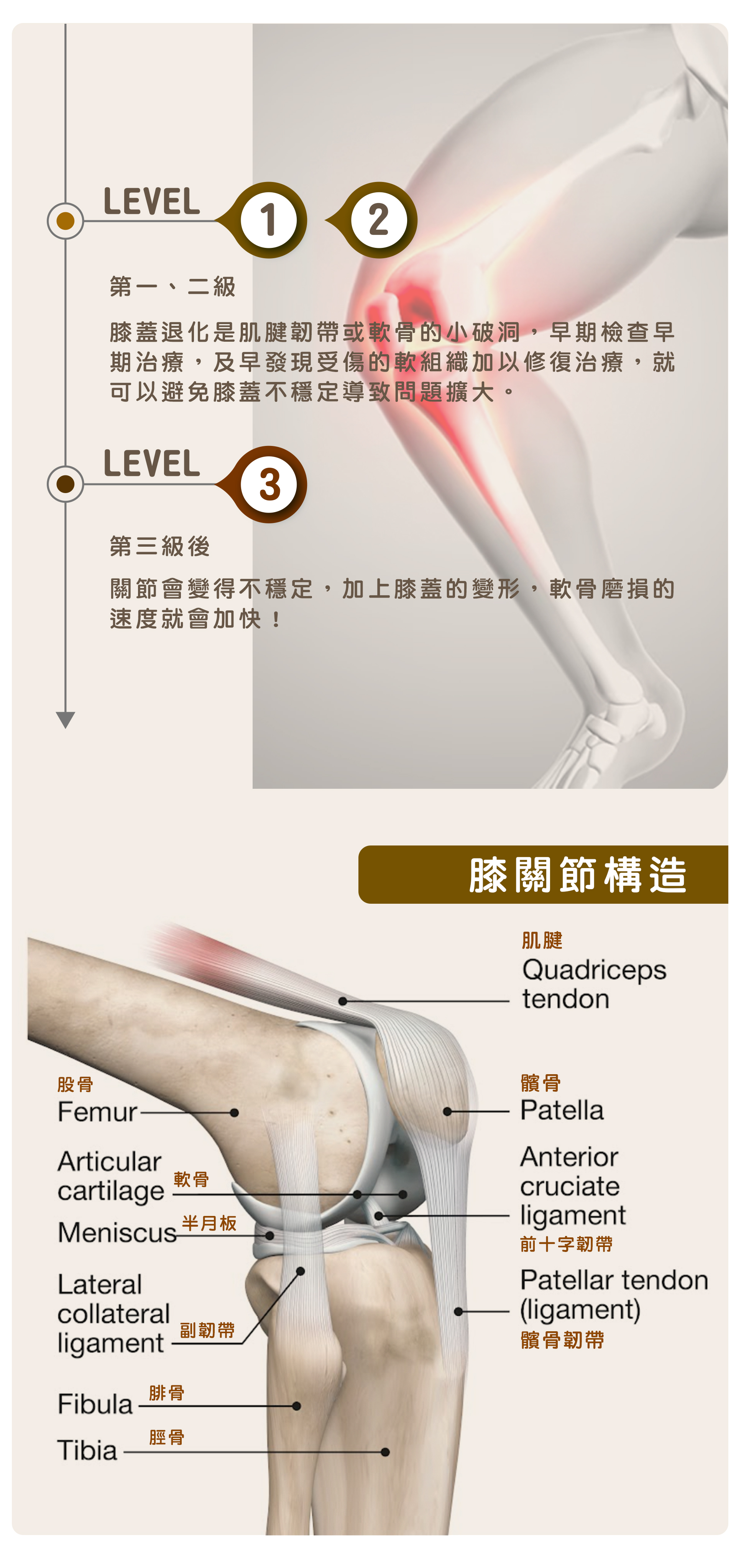 退化性關節炎