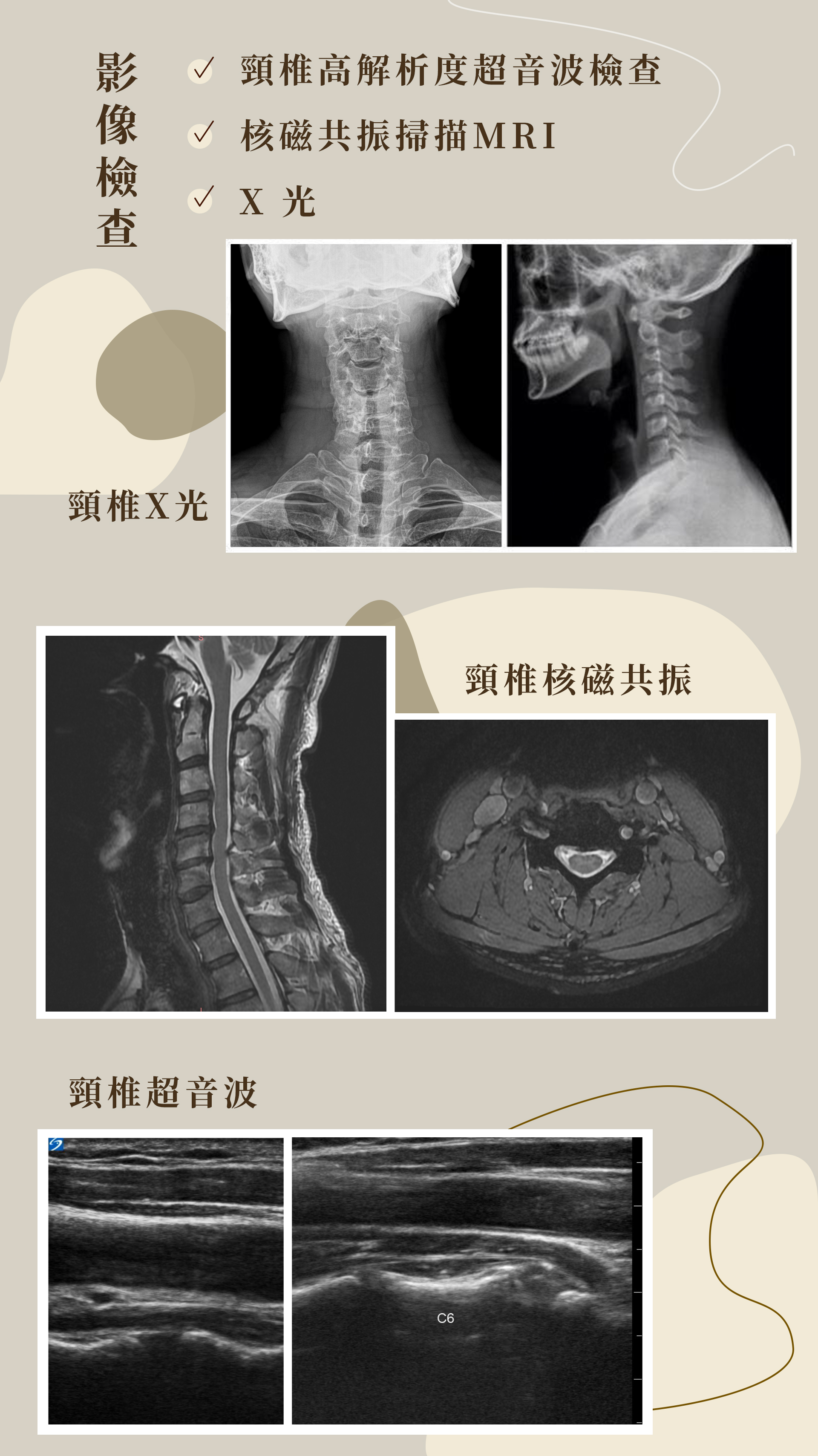 頸椎超音波與MRI